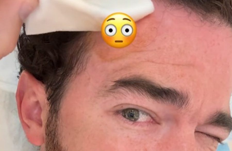 Kevin Jonas skin cancer removal Instagram ONE USE BangShowbiz